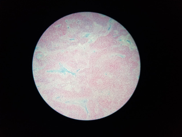 Reticular Connective Slides - Reticular Connective 01 100X
